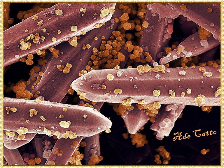 Descrição da imagem. A imagem apresenta uma foto obtida por microscopia eletrônica de varredura após passar por tratamento de imagem. A imagem é composta em sua totalidade por diversos bastões, assemelhando-se a forma de lápis, de cor lilás os quais estão dispersos por toda imagem de forma aleatória. Na superfície destes bastões é possível observar pequenas esferas de cor laranja. Fim da descrição.